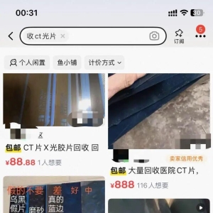 1.5元收旧CT片？别卖！非法炼银，污染还致癌